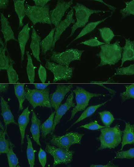 CGRP Rabbit polyclonal antibody