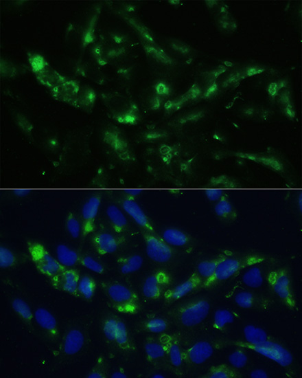 CGRP Rabbit polyclonal antibody