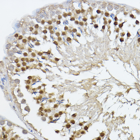 PRDM14 Rabbit polyclonal antibody
