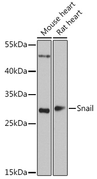 Snail Rabbit polyclonal antibody