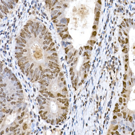 Snail Rabbit polyclonal antibody