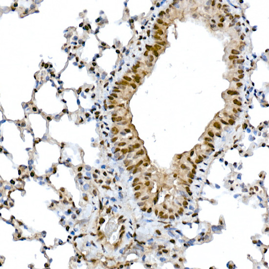 Snail Rabbit polyclonal antibody