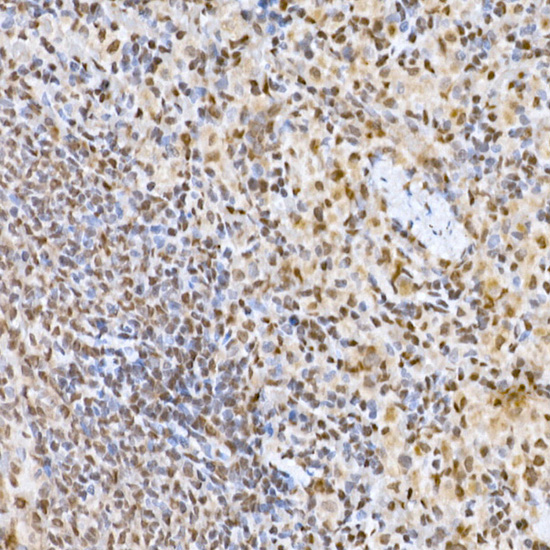 Snail Rabbit polyclonal antibody