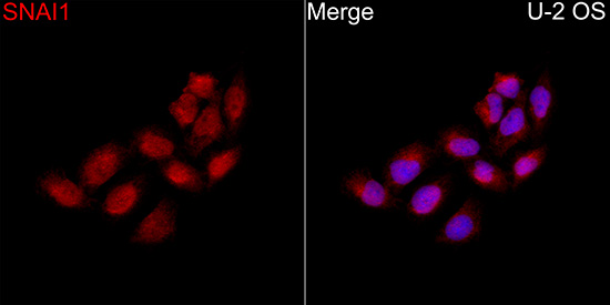 Snail Rabbit polyclonal antibody
