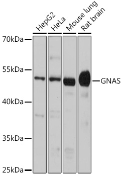 GNAS Rabbit polyclonal antibody