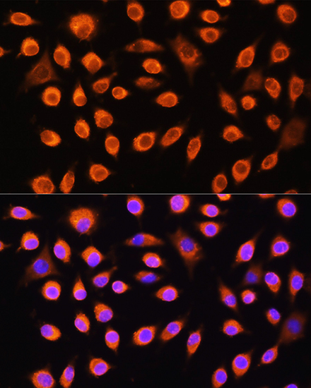 GNAS Rabbit polyclonal antibody