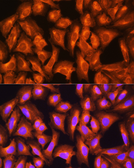 GNAS Rabbit polyclonal antibody
