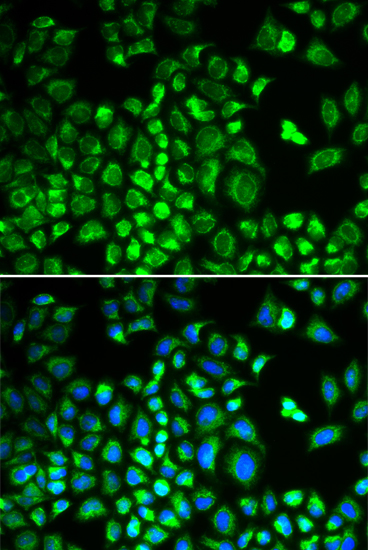 HAX1 Rabbit polyclonal antibody