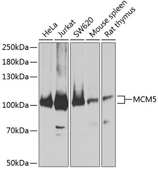 MCM5 Rabbit polyclonal antibody