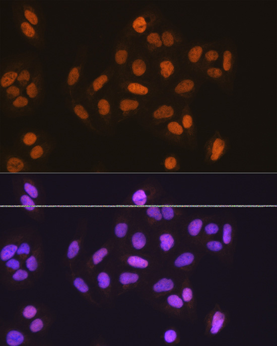 MCM5 Rabbit polyclonal antibody