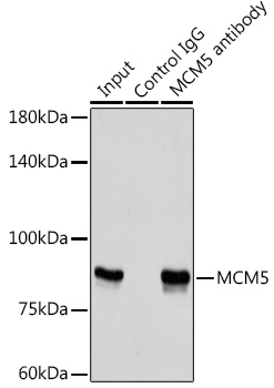 MCM5 Rabbit polyclonal antibody