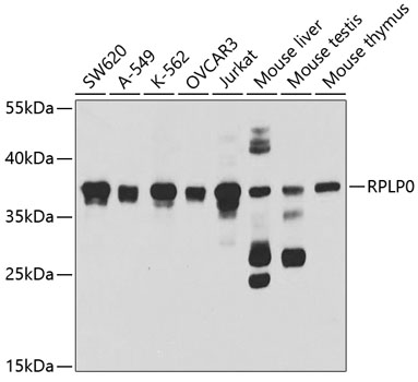 RPLP0 Rabbit polyclonal antibody