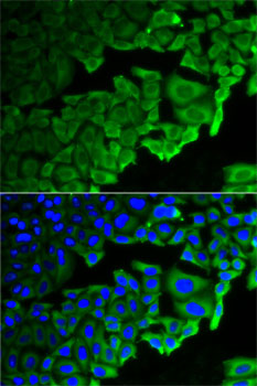 RPLP0 Rabbit polyclonal antibody