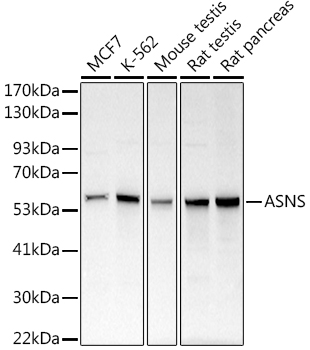 ASNS Rabbit polyclonal antibody