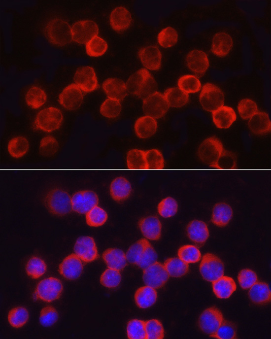 ASNS Rabbit polyclonal antibody