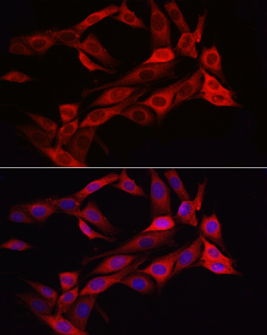 ASNS Rabbit polyclonal antibody