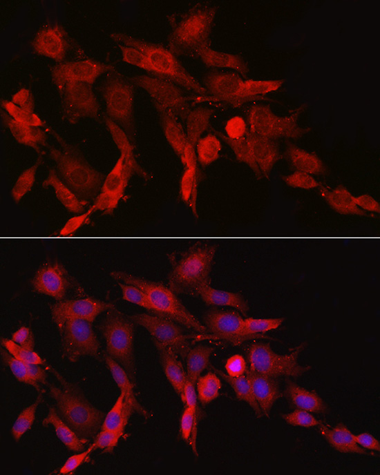ASNS Rabbit polyclonal antibody