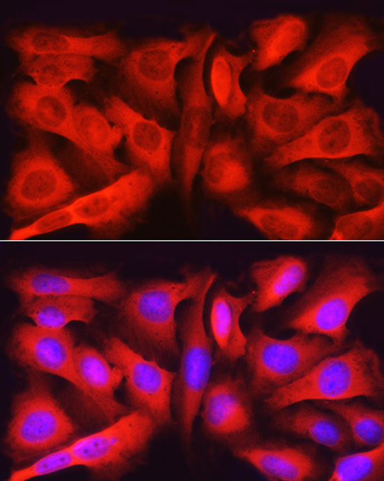 ASNS Rabbit polyclonal antibody