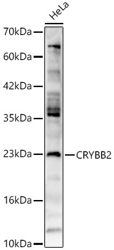CRYBB2 Rabbit polyclonal antibody