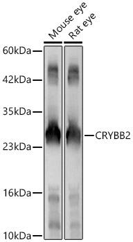 CRYBB2 Rabbit polyclonal antibody