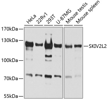 SKIV2L2 Rabbit polyclonal antibody
