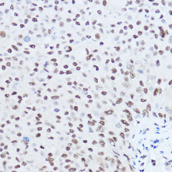 SKIV2L2 Rabbit polyclonal antibody