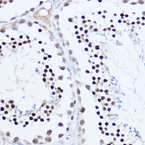 SKIV2L2 Rabbit polyclonal antibody