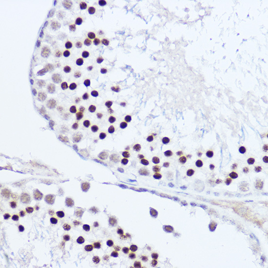 SKIV2L2 Rabbit polyclonal antibody