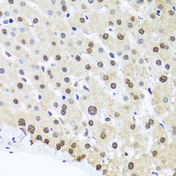 FUBP1 Rabbit polyclonal antibody