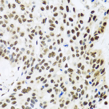 FUBP1 Rabbit polyclonal antibody