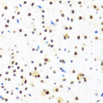 FUBP1 Rabbit polyclonal antibody