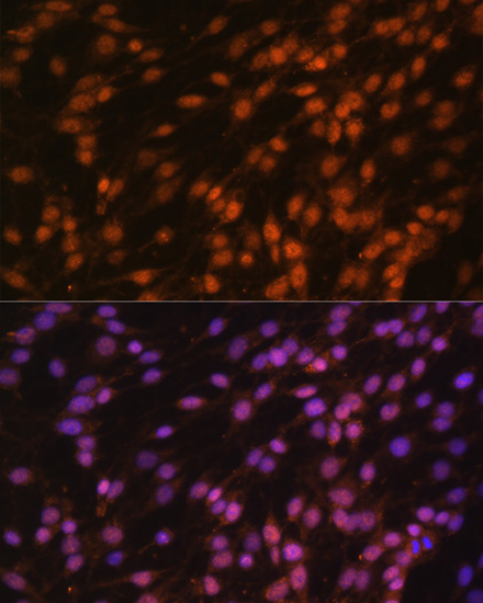 FUBP1 Rabbit polyclonal antibody