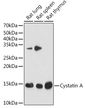 Cystatin A Rabbit monoclonal antibody