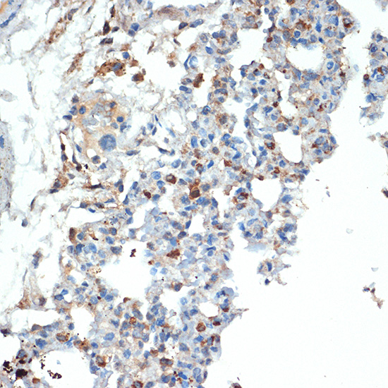 Cystatin A Rabbit monoclonal antibody