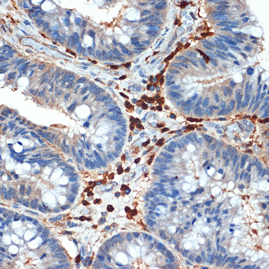 Cystatin A Rabbit monoclonal antibody