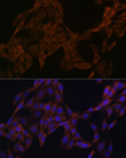 Cystatin A Rabbit monoclonal antibody