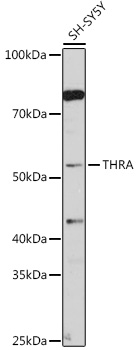 THRA Rabbit polyclonal antibody
