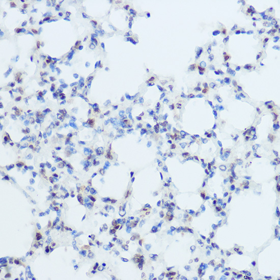 THRA Rabbit polyclonal antibody
