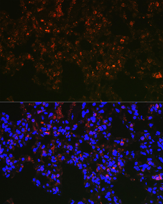 NAPSA Rabbit polyclonal antibody