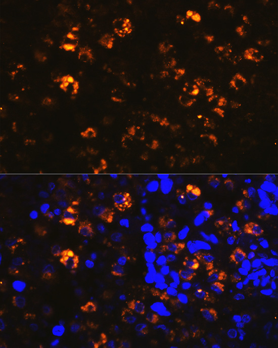 NAPSA Rabbit polyclonal antibody