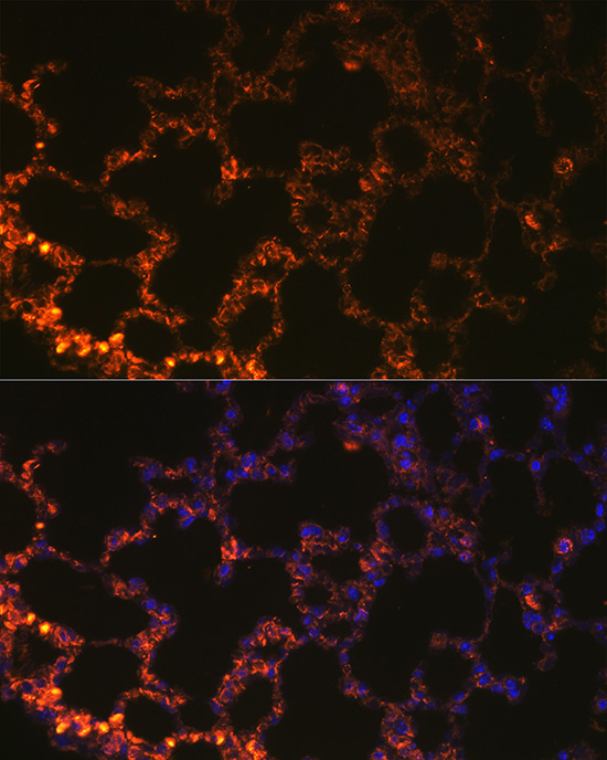 NAPSA Rabbit polyclonal antibody