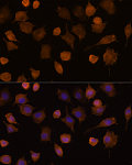 Western blot - ICAM-1/CD54 Rabbit pAb (A5597)