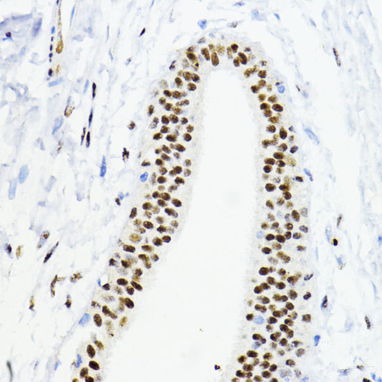 ZEB1 Rabbit polyclonal antibody