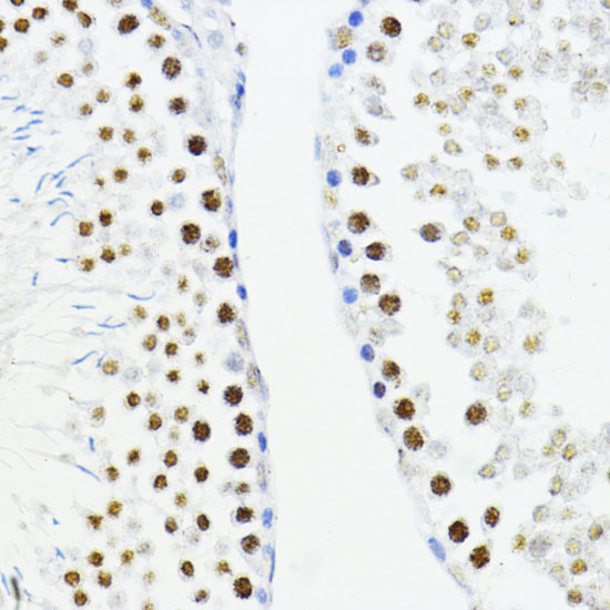 ZEB1 Rabbit polyclonal antibody