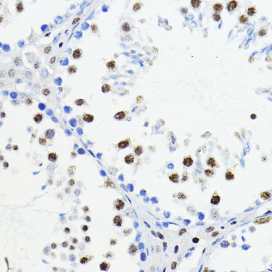 ZEB1 Rabbit polyclonal antibody