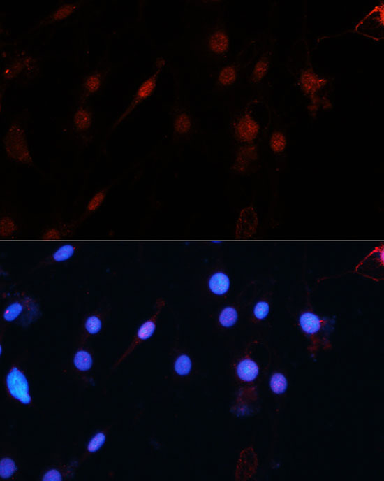 ZEB1 Rabbit polyclonal antibody