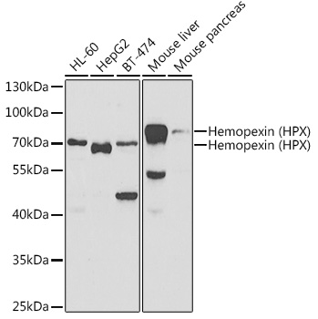 Hemopexin (HPX) Rabbit pAb