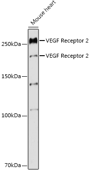 VEGF Receptor 2 Rabbit polyclonal antibody