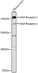 Western blot - VEGF Receptor 2 Rabbit pAb (A5609)