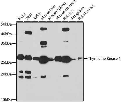 Thymidine Kinase 1 Rabbit polyclonal antibody